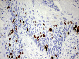 TOP2A Antibody in Immunohistochemistry (Paraffin) (IHC (P))