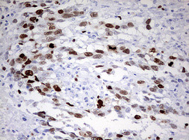 TOP2A Antibody in Immunohistochemistry (Paraffin) (IHC (P))