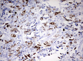 TOP2A Antibody in Immunohistochemistry (Paraffin) (IHC (P))