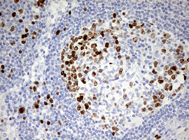 TOP2A Antibody in Immunohistochemistry (Paraffin) (IHC (P))