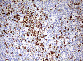 TOP2A Antibody in Immunohistochemistry (Paraffin) (IHC (P))