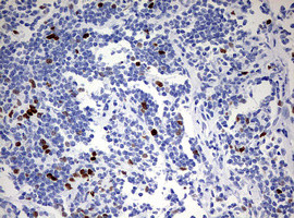 TOP2A Antibody in Immunohistochemistry (Paraffin) (IHC (P))