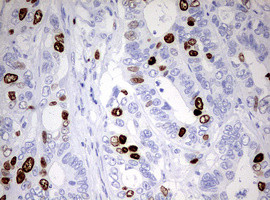 TOP2A Antibody in Immunohistochemistry (Paraffin) (IHC (P))