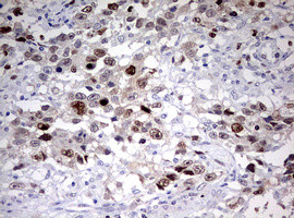 TOP2A Antibody in Immunohistochemistry (Paraffin) (IHC (P))