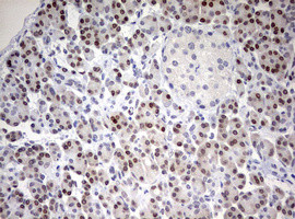 TOP2A Antibody in Immunohistochemistry (Paraffin) (IHC (P))