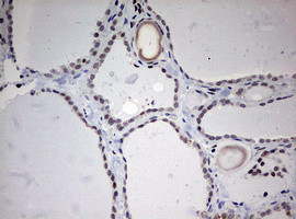 TOP2A Antibody in Immunohistochemistry (Paraffin) (IHC (P))