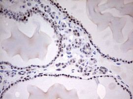 TOP2A Antibody in Immunohistochemistry (Paraffin) (IHC (P))