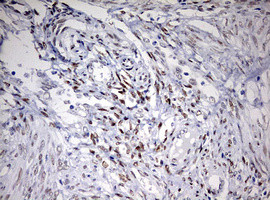 TOP2A Antibody in Immunohistochemistry (Paraffin) (IHC (P))