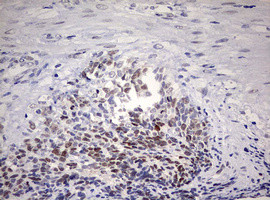 TOP2A Antibody in Immunohistochemistry (Paraffin) (IHC (P))