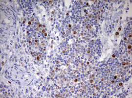 TOP2A Antibody in Immunohistochemistry (Paraffin) (IHC (P))