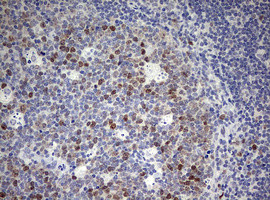 TOP2A Antibody in Immunohistochemistry (Paraffin) (IHC (P))