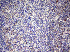 TOP2A Antibody in Immunohistochemistry (Paraffin) (IHC (P))