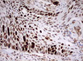 TOP2A Antibody in Immunohistochemistry (Paraffin) (IHC (P))