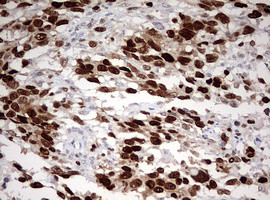 TOP2A Antibody in Immunohistochemistry (Paraffin) (IHC (P))