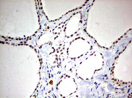 TOP2A Antibody in Immunohistochemistry (Paraffin) (IHC (P))