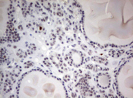 TOP2A Antibody in Immunohistochemistry (Paraffin) (IHC (P))