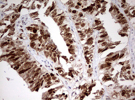 TOP2A Antibody in Immunohistochemistry (Paraffin) (IHC (P))