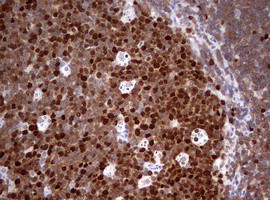 TOP2A Antibody in Immunohistochemistry (Paraffin) (IHC (P))