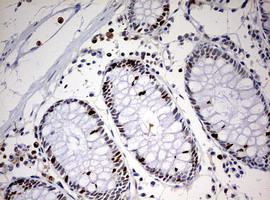 TOP2A Antibody in Immunohistochemistry (Paraffin) (IHC (P))