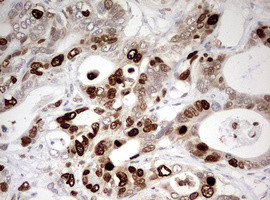 TOP2A Antibody in Immunohistochemistry (Paraffin) (IHC (P))