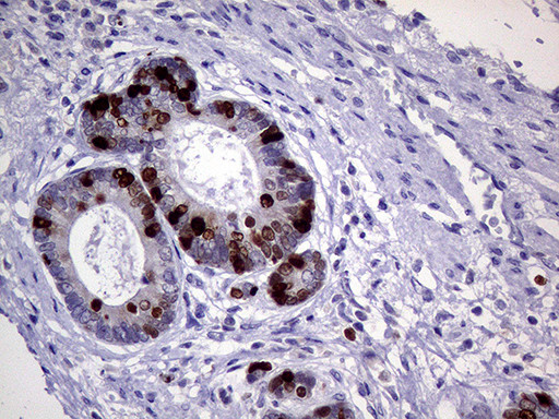 TOP2A Antibody in Immunohistochemistry (Paraffin) (IHC (P))