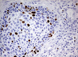 TOP2A Antibody in Immunohistochemistry (Paraffin) (IHC (P))