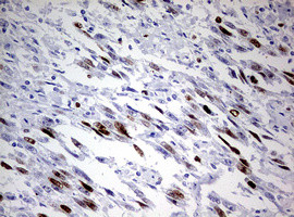 TOP2A Antibody in Immunohistochemistry (Paraffin) (IHC (P))