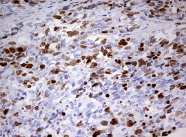 TOP2A Antibody in Immunohistochemistry (Paraffin) (IHC (P))