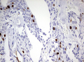 TOP2A Antibody in Immunohistochemistry (Paraffin) (IHC (P))