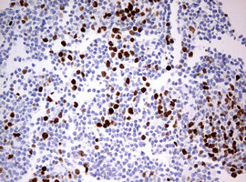 TOP2A Antibody in Immunohistochemistry (Paraffin) (IHC (P))