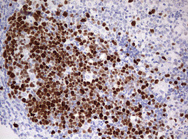 TOP2A Antibody in Immunohistochemistry (Paraffin) (IHC (P))