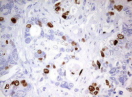 TOP2A Antibody in Immunohistochemistry (Paraffin) (IHC (P))