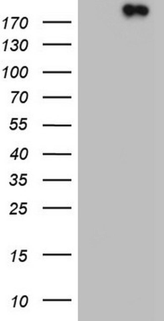 TOP2A Antibody in Western Blot (WB)