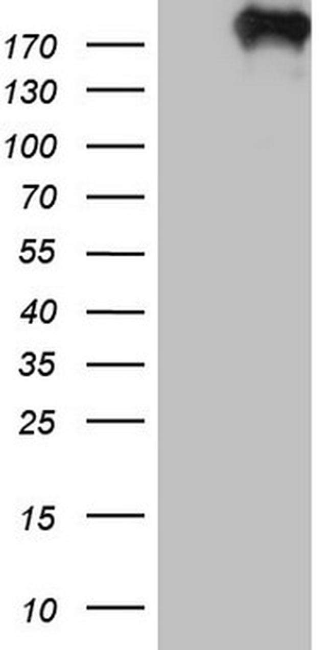 TOP2A Antibody in Western Blot (WB)