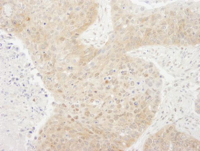 TORC1 Antibody in Immunohistochemistry (IHC)