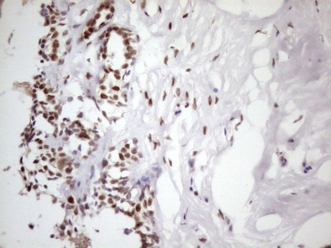 TP53BP1 Antibody in Immunohistochemistry (Paraffin) (IHC (P))