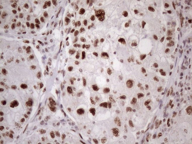 TP53BP1 Antibody in Immunohistochemistry (Paraffin) (IHC (P))