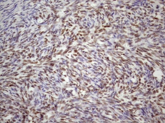 TP53BP1 Antibody in Immunohistochemistry (Paraffin) (IHC (P))