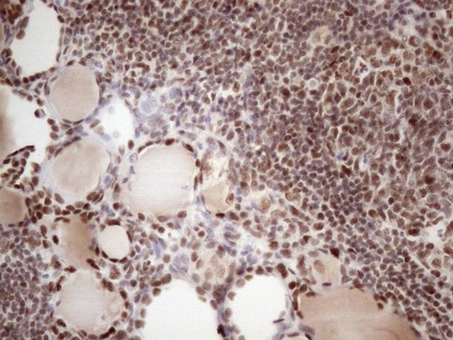 TP53BP1 Antibody in Immunohistochemistry (Paraffin) (IHC (P))