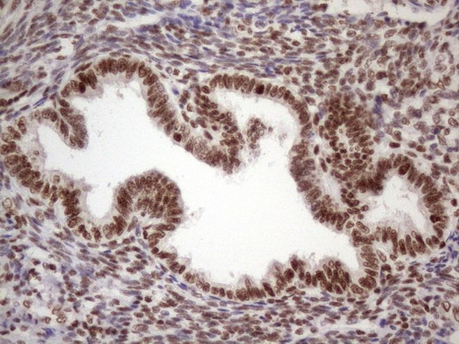 TP53BP1 Antibody in Immunohistochemistry (Paraffin) (IHC (P))