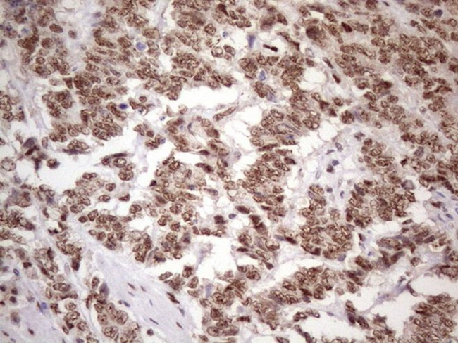 TP53BP1 Antibody in Immunohistochemistry (Paraffin) (IHC (P))