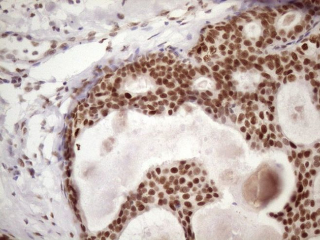 TP53BP1 Antibody in Immunohistochemistry (Paraffin) (IHC (P))