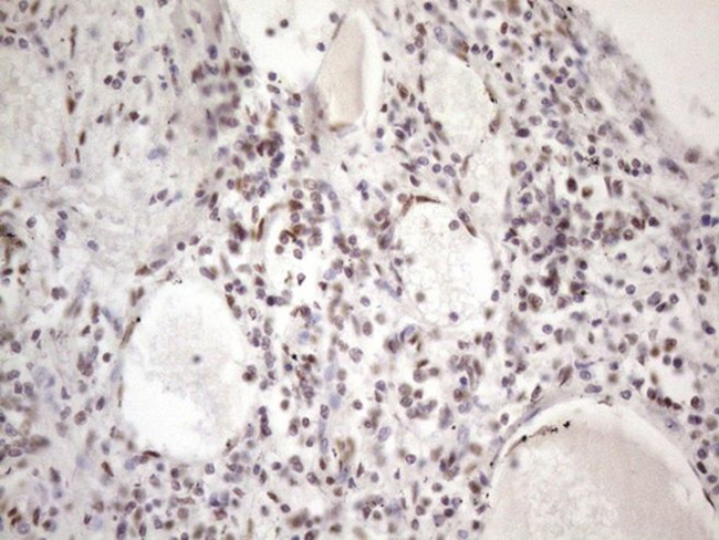 TP53BP1 Antibody in Immunohistochemistry (Paraffin) (IHC (P))