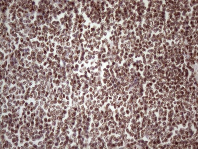 TP53BP1 Antibody in Immunohistochemistry (Paraffin) (IHC (P))