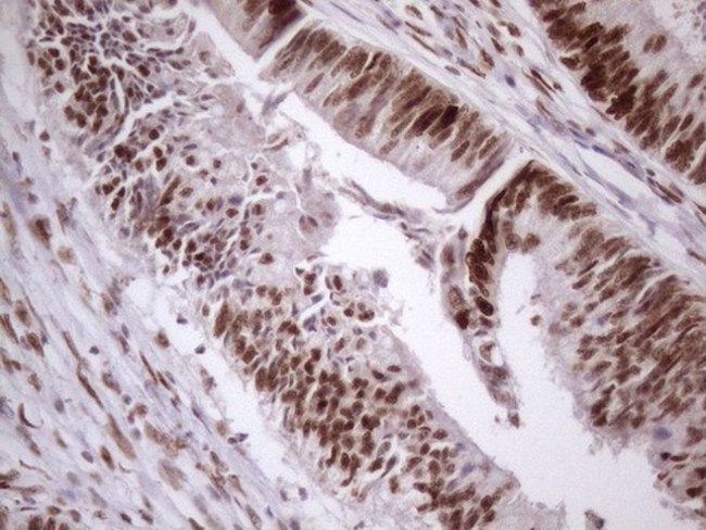 TP53BP1 Antibody in Immunohistochemistry (Paraffin) (IHC (P))