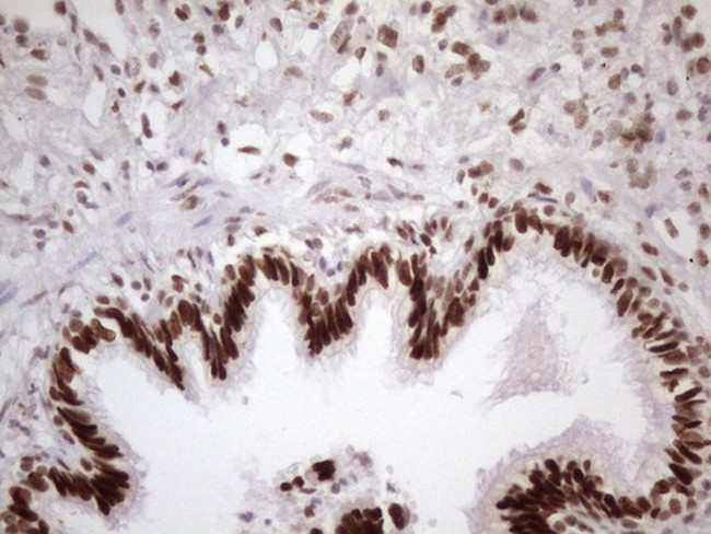 TP53BP1 Antibody in Immunohistochemistry (Paraffin) (IHC (P))