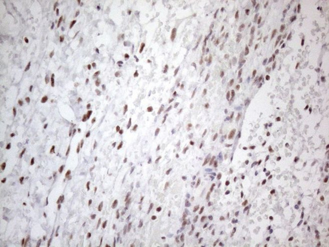 TP53BP1 Antibody in Immunohistochemistry (Paraffin) (IHC (P))