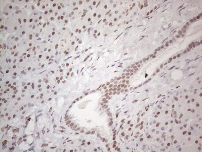 TP53BP1 Antibody in Immunohistochemistry (Paraffin) (IHC (P))