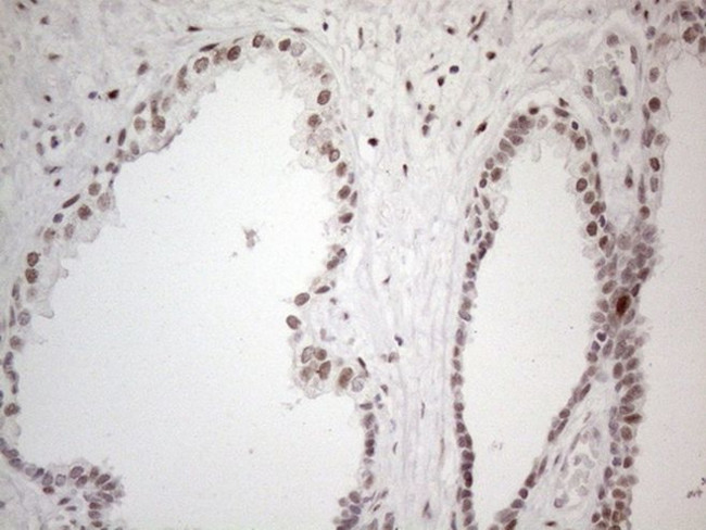 TP53BP1 Antibody in Immunohistochemistry (Paraffin) (IHC (P))