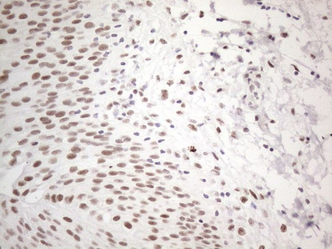 TP53BP1 Antibody in Immunohistochemistry (Paraffin) (IHC (P))